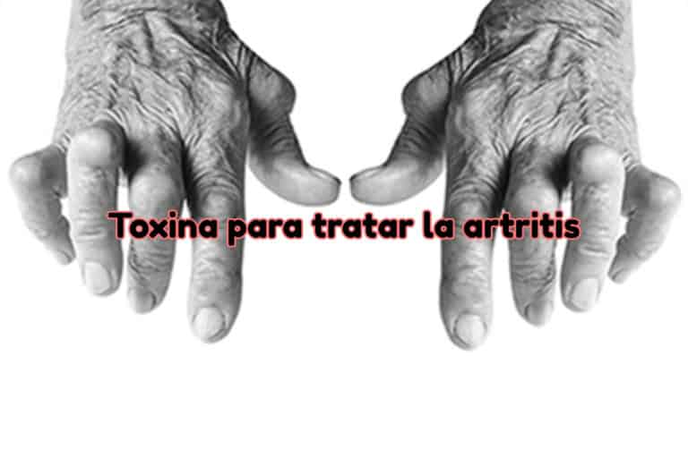 tratar la artritis con toxina