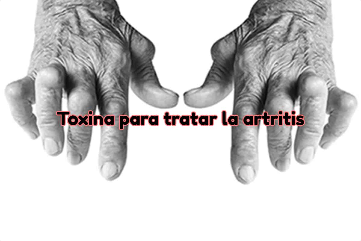 tratar la artritis con toxina